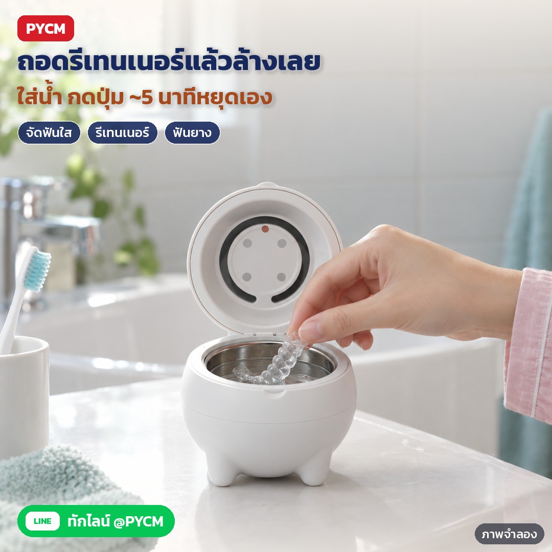 เครื่องล้างอัลตราโซนิค ล้างรีเทนเนอร์ 180 มล. URC – ภาพจำลองด้วย AI (ภาพประกอบ ไม่ใช่ภาพถ่ายจริง): ถอดรีเทนเนอร์/จัดฟันใสแล้ววางลงถังที่เติมน้ำไว้ ปิดฝา กดปุ่ม เครื่องทำงานประมาณ 5 นาทีแล้วหยุดเอง จากนั้นล้างน้ำเปล่า (ไม่ใช่อุปกรณ์การแพทย์ ยังควรแปรงทำความสะอาดตามคำแนะนำทันตแพทย์)