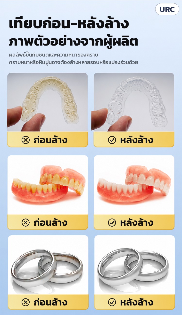 เครื่องล้างอัลตราโซนิค ล้างรีเทนเนอร์ 180 มล. URC – เทียบก่อน-หลังล้าง รีเทนเนอร์ ฟันปลอม แหวน (ภาพตัวอย่างจากผู้ผลิต ผลลัพธ์ขึ้นกับชนิดและความหนาของคราบ)